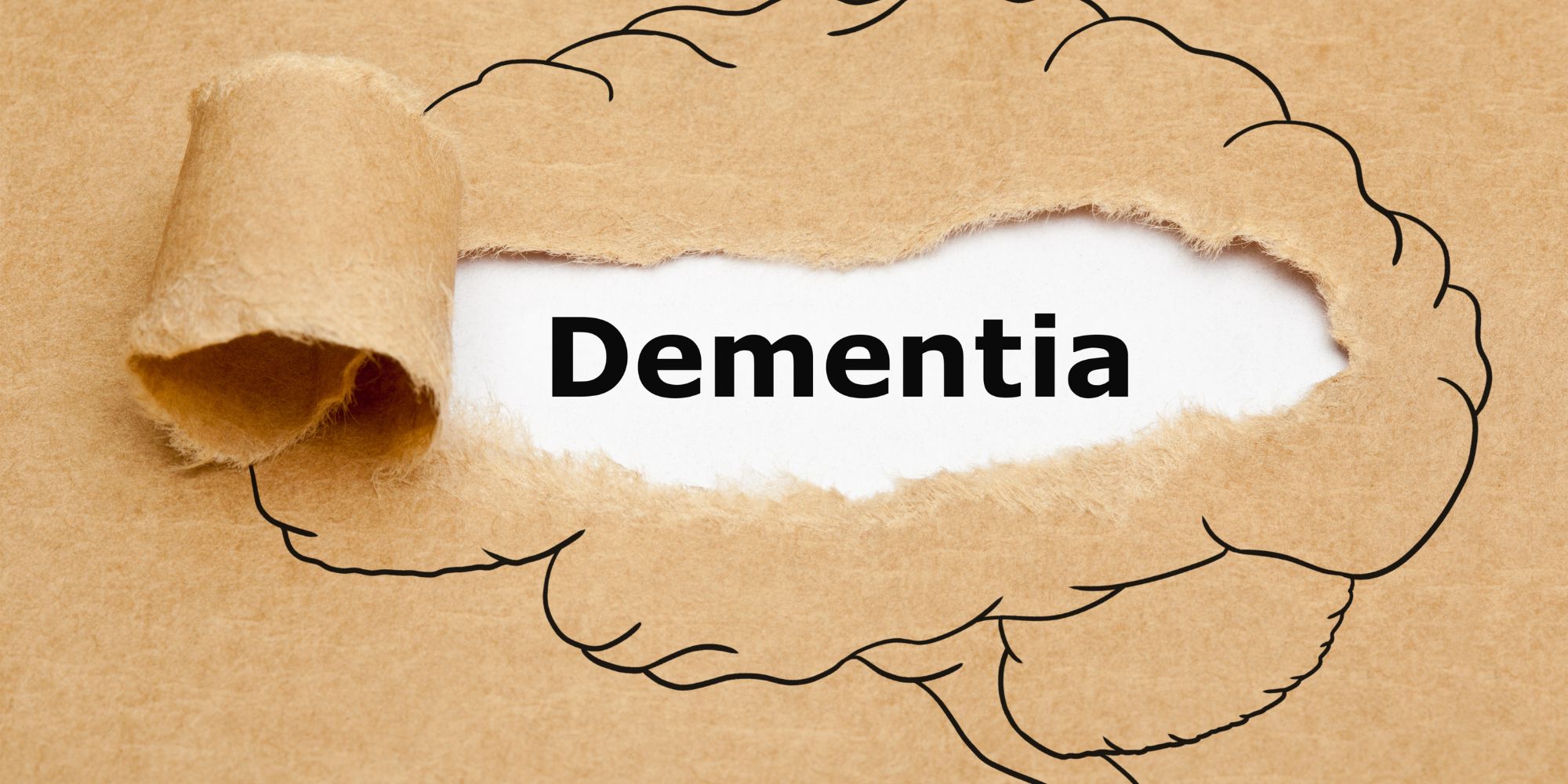 Are Alcoholics More Prone To Dementia