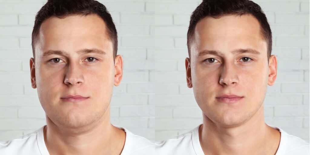 Does Alcohol Bloat Your Face