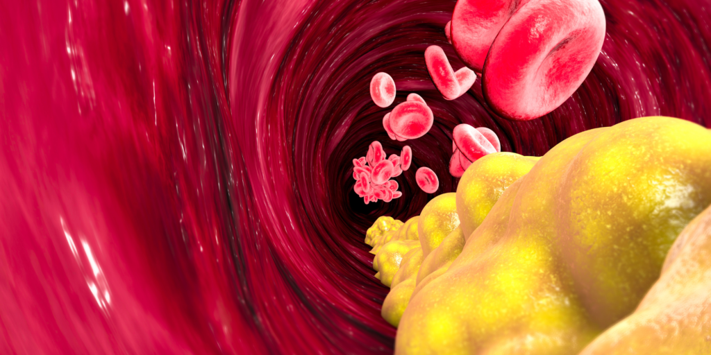 Does Cocaine Cause High Cholesterol